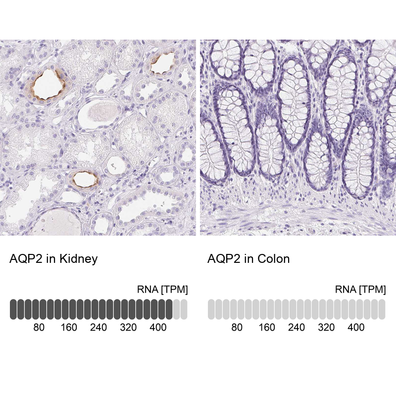 Atlas Antibodies Anti-AQP2 Antibody