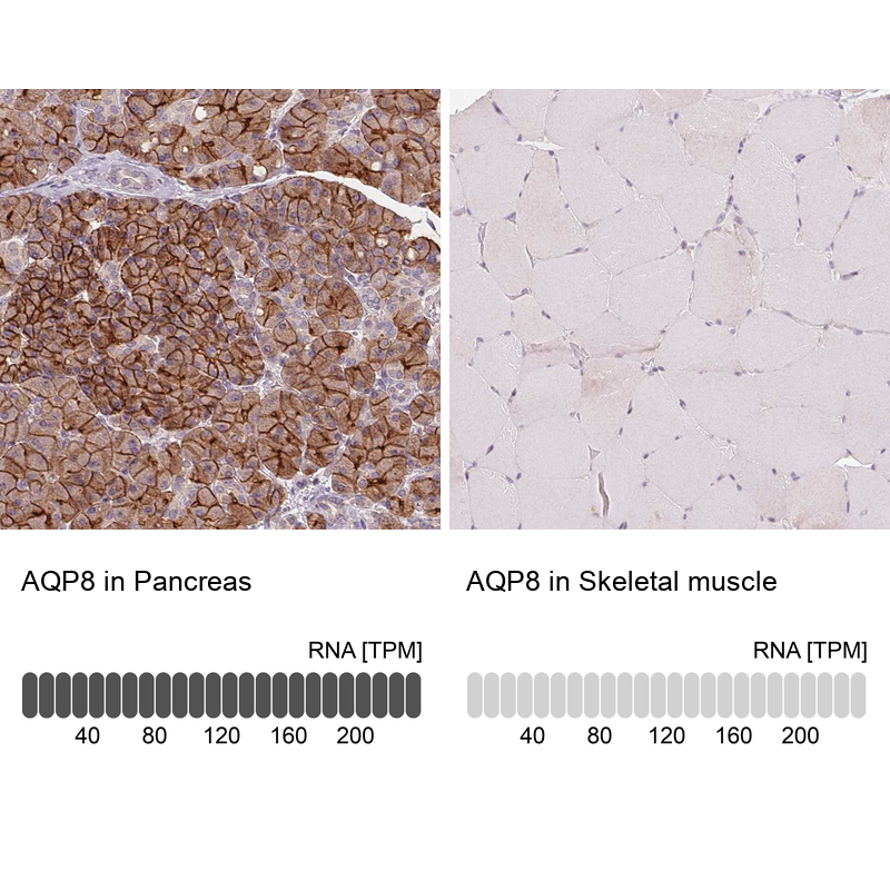 Atlas Antibodies Anti-AQP8 Antibody