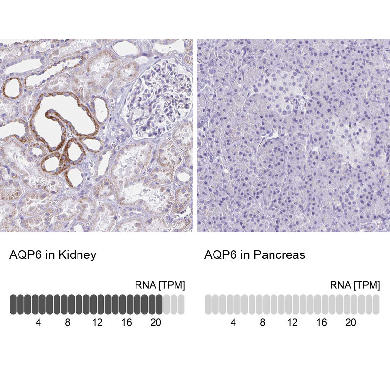 Atlas Antibodies Anti-AQP6 Antibody