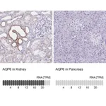 Atlas Antibodies Anti-AQP6 Antibody