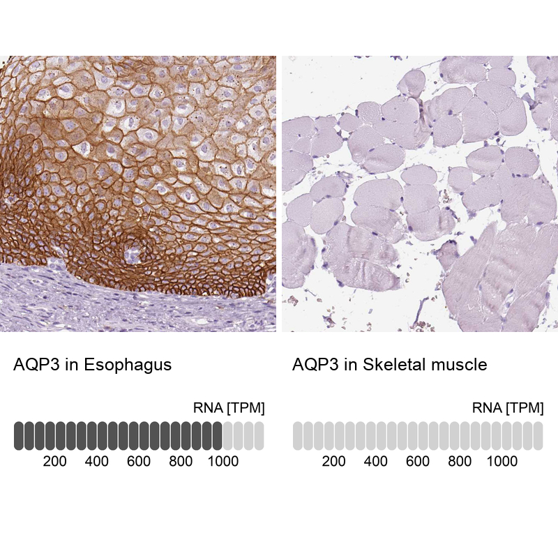 Atlas Antibodies Anti-AQP3 Antibody