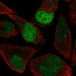 Atlas Antibodies Anti-AQR Antibody