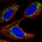 Atlas Antibodies Anti-AR Antibody