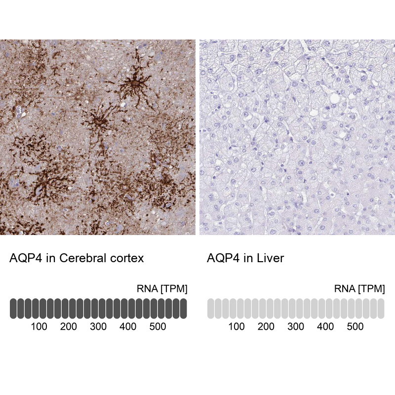 Atlas Antibodies Anti-AQP4 Antibody