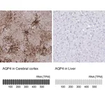 Atlas Antibodies Anti-AQP4 Antibody