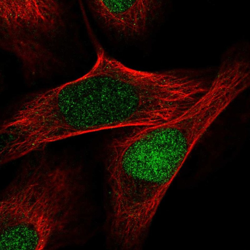Atlas Antibodies Anti-AQR Antibody