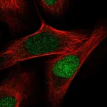Atlas Antibodies Anti-AQR Antibody
