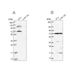 Atlas Antibodies Anti-ARAF Antibody