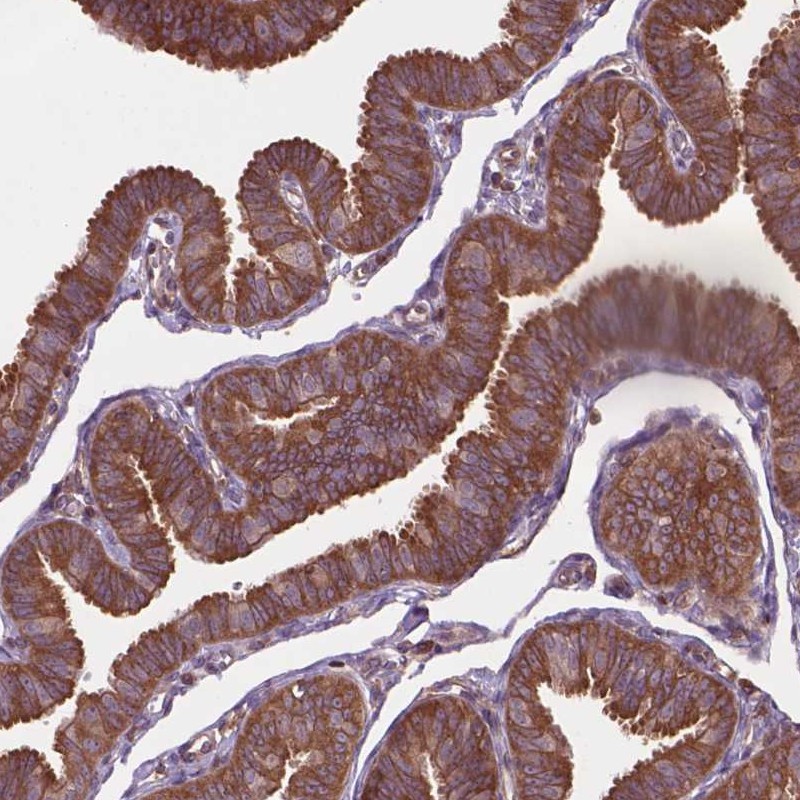 Atlas Antibodies Anti-ARAF Antibody