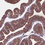 Atlas Antibodies Anti-ARAF Antibody