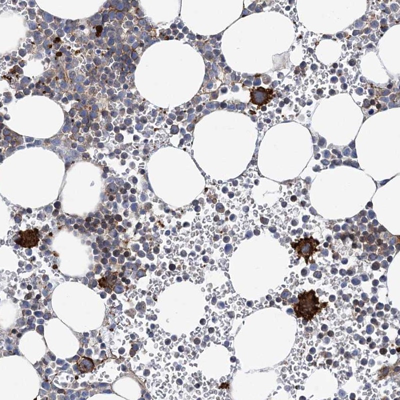 Atlas Antibodies Anti-ARAP2 Antibody