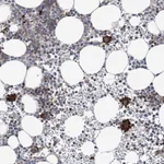 Atlas Antibodies Anti-ARAP2 Antibody