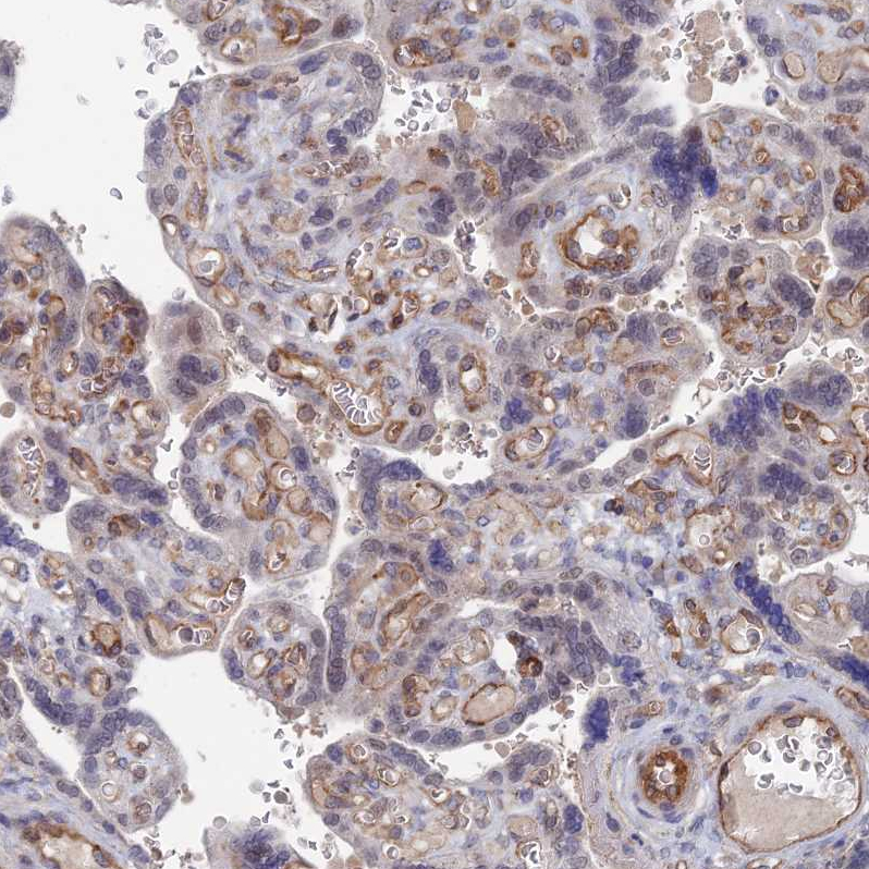 Atlas Antibodies Anti-ARAP3 Antibody