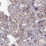 Atlas Antibodies Anti-ARAP3 Antibody
