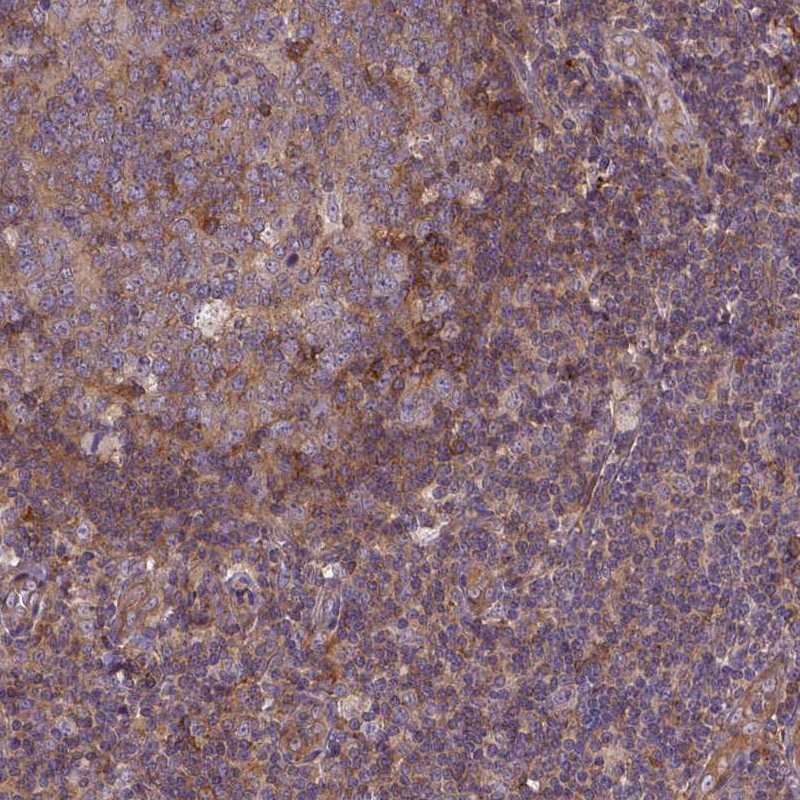 Atlas Antibodies Anti-ARAP1 Antibody