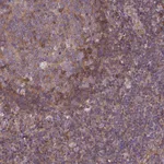 Atlas Antibodies Anti-ARAP1 Antibody