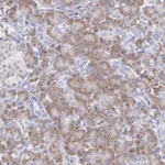 Atlas Antibodies Anti-ARFGAP3 Antibody