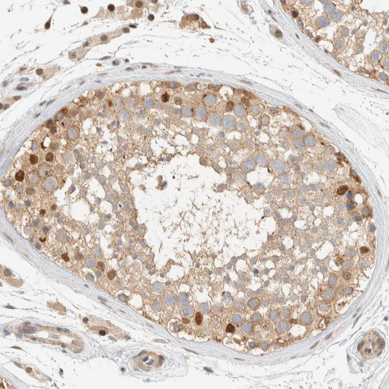 Atlas Antibodies Anti-ARFGEF1 Antibody