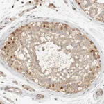 Atlas Antibodies Anti-ARFGEF1 Antibody
