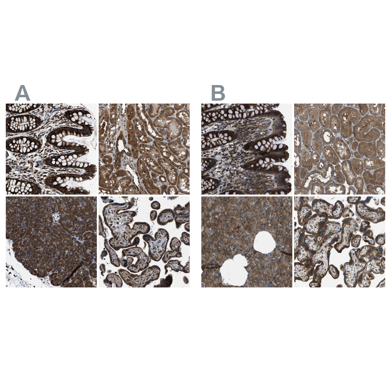 Atlas Antibodies Anti-ARFGAP2 Antibody