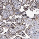 Atlas Antibodies Anti-ARFGAP1 Antibody