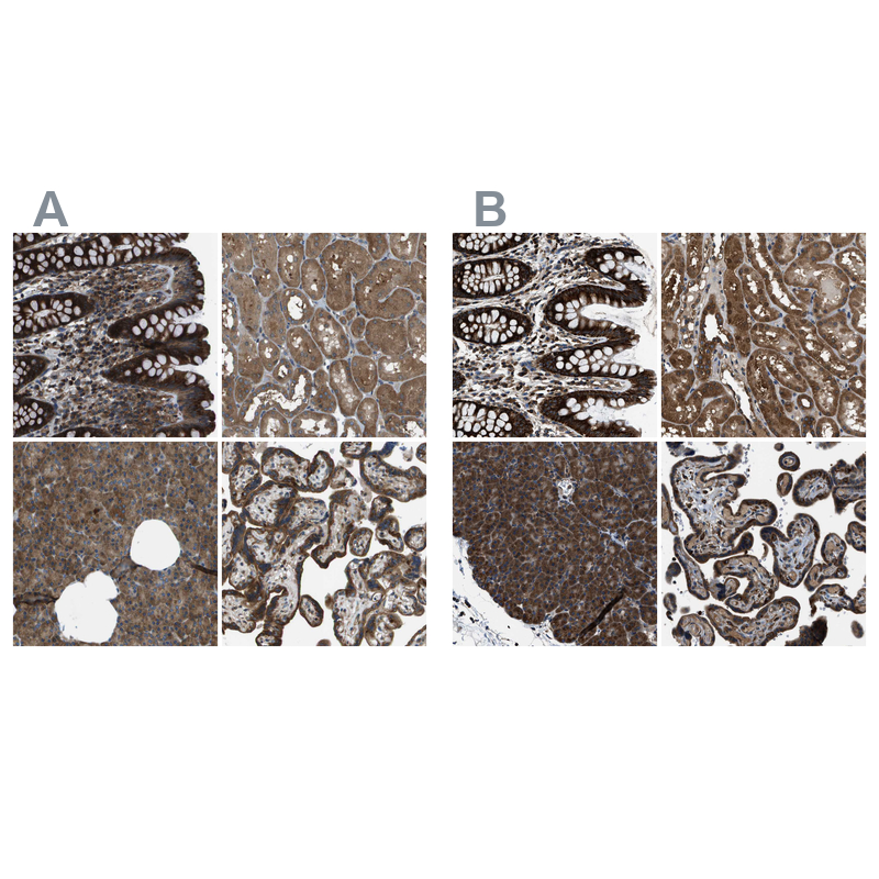 Atlas Antibodies Anti-ARFGAP2 Antibody