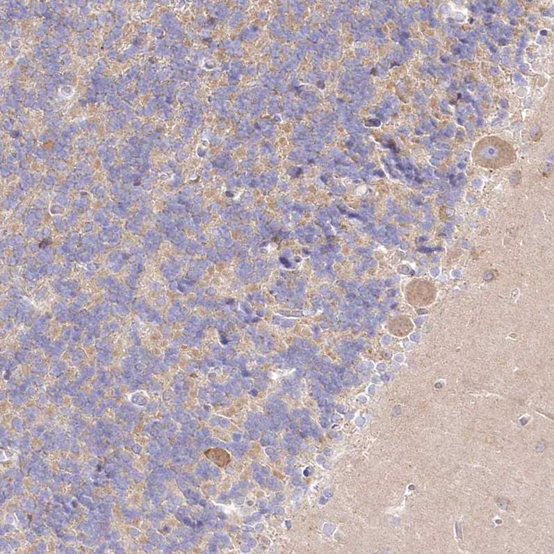 Atlas Antibodies Anti-ARFGEF3 Antibody