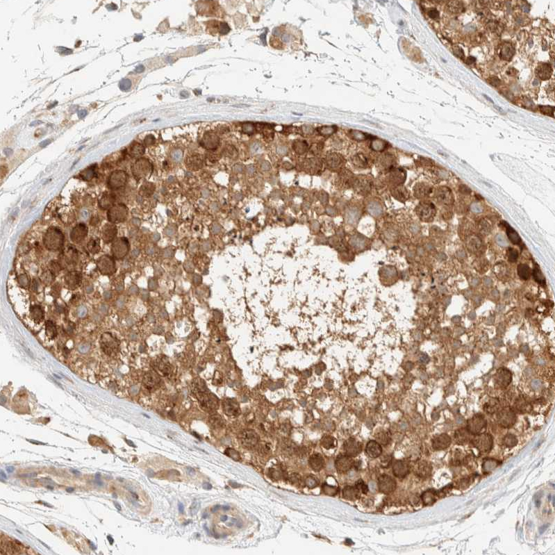 Atlas Antibodies Anti-ARFGEF1 Antibody