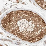 Atlas Antibodies Anti-ARFGEF1 Antibody
