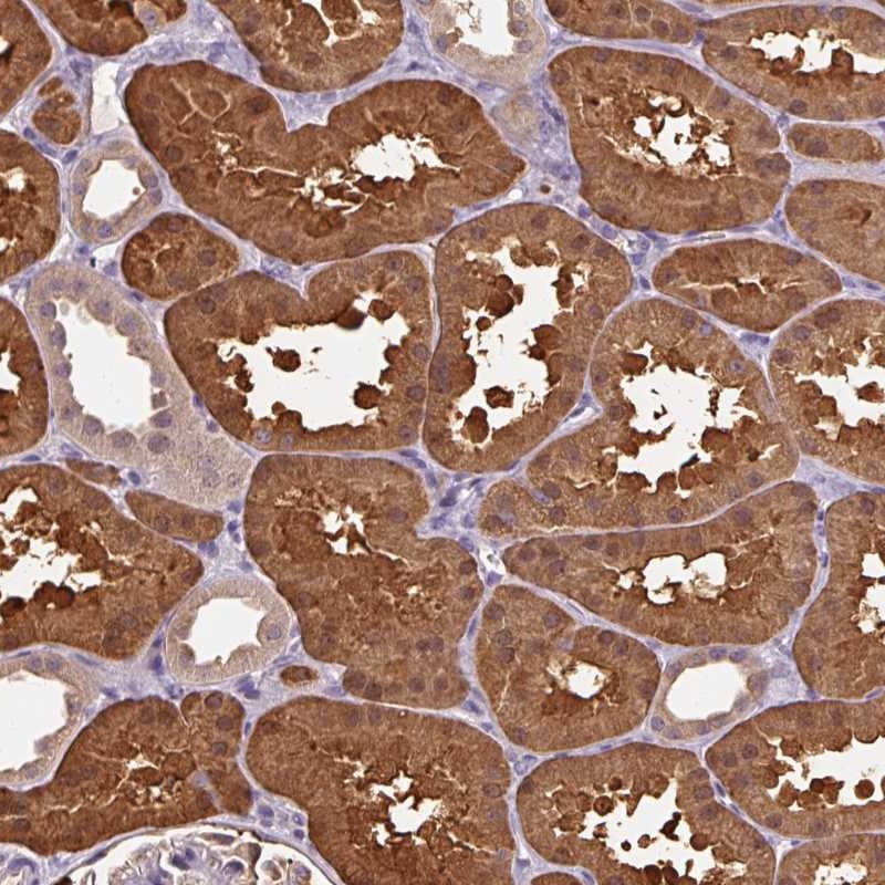 Atlas Antibodies Anti-ARFIP1 Antibody