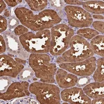 Atlas Antibodies Anti-ARFIP1 Antibody