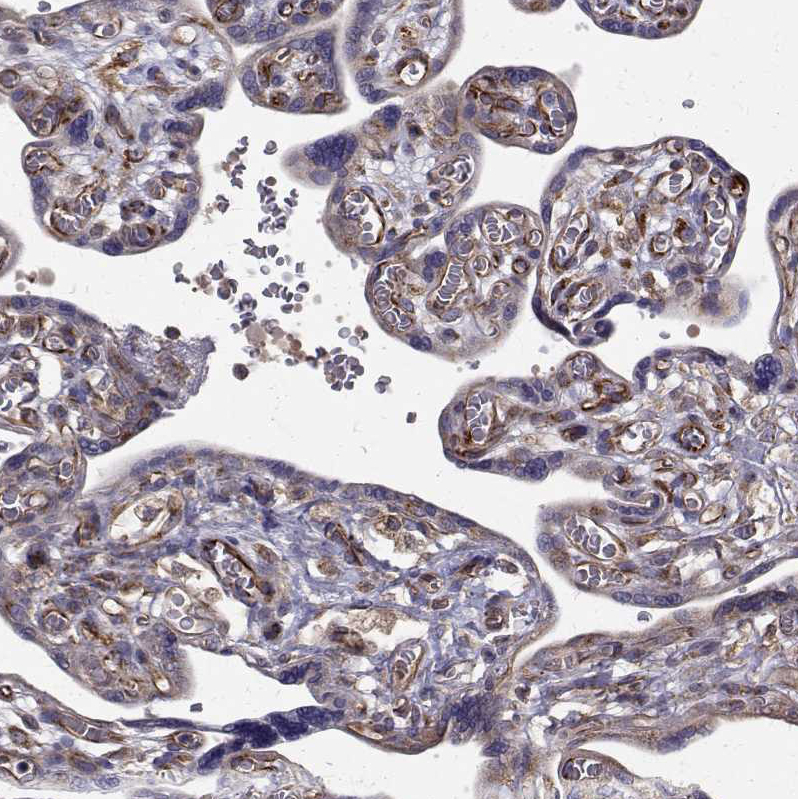 Atlas Antibodies Anti-ARFGAP1 Antibody