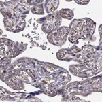 Atlas Antibodies Anti-ARFGAP1 Antibody