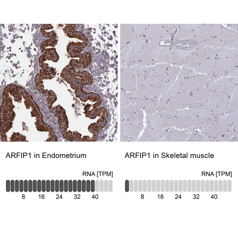Atlas Antibodies Anti-ARFIP1 Antibody
