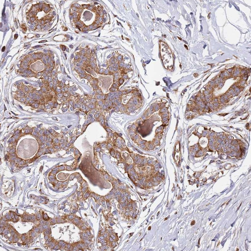 Atlas Antibodies Anti-ARFRP1 Antibody