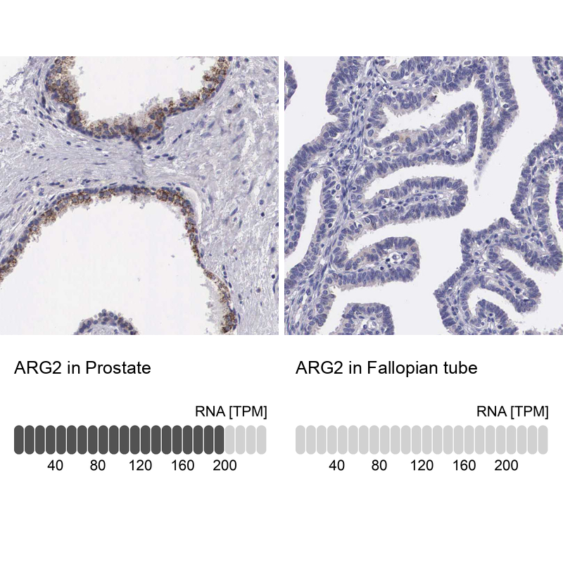 Atlas Antibodies Anti-ARG2 Antibody