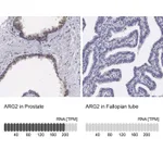 Atlas Antibodies Anti-ARG2 Antibody