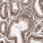 Atlas Antibodies Anti-ARGLU1 Antibody