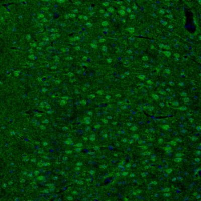 Atlas Antibodies Anti-ARHGAP1 Antibody