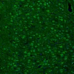 Atlas Antibodies Anti-ARHGAP1 Antibody