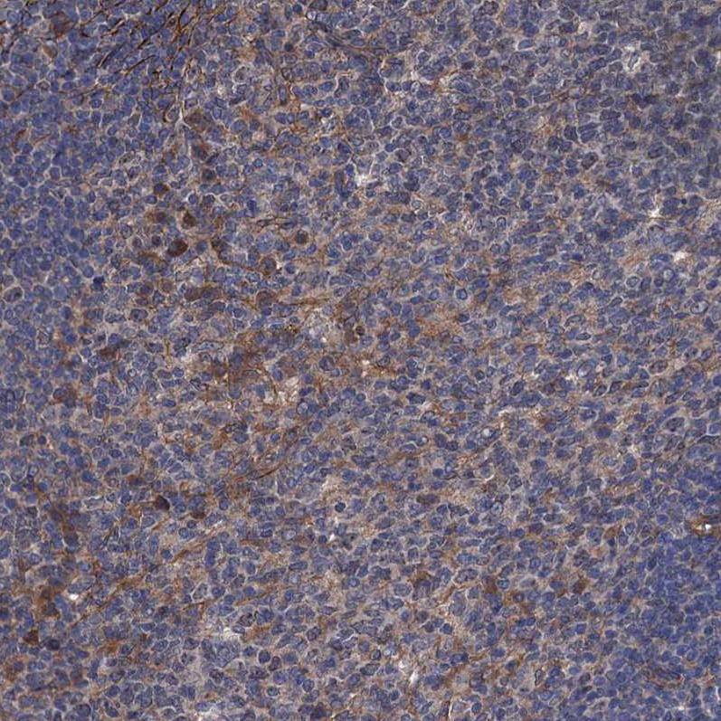 Atlas Antibodies Anti-ARHGAP11A Antibody