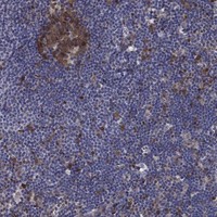 Atlas Antibodies Anti-ARHGAP11A Antibody