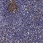 Atlas Antibodies Anti-ARHGAP11A Antibody