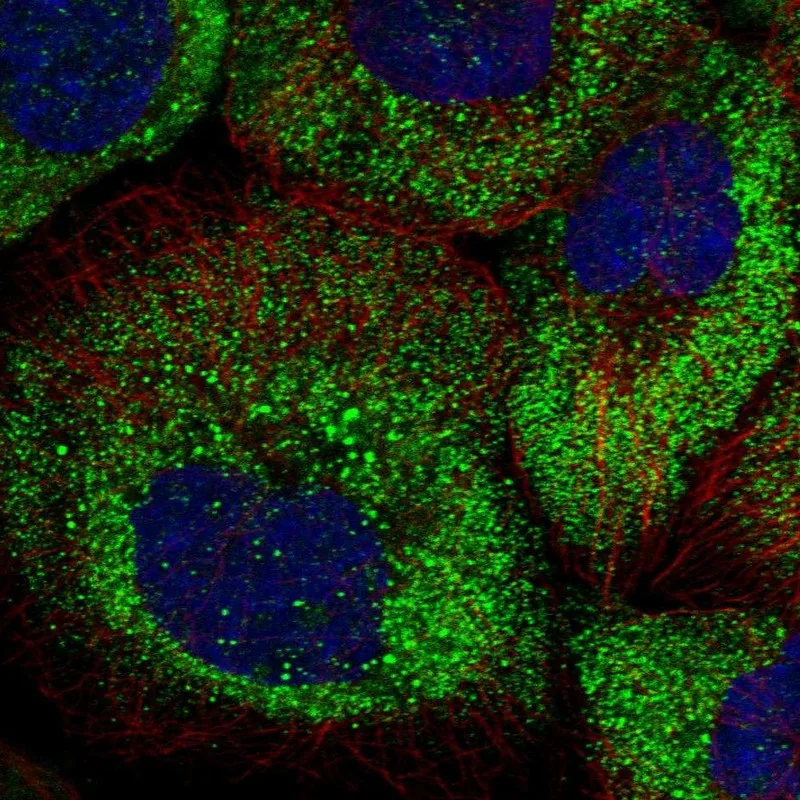 Atlas Antibodies Anti-ARHGAP11A Antibody