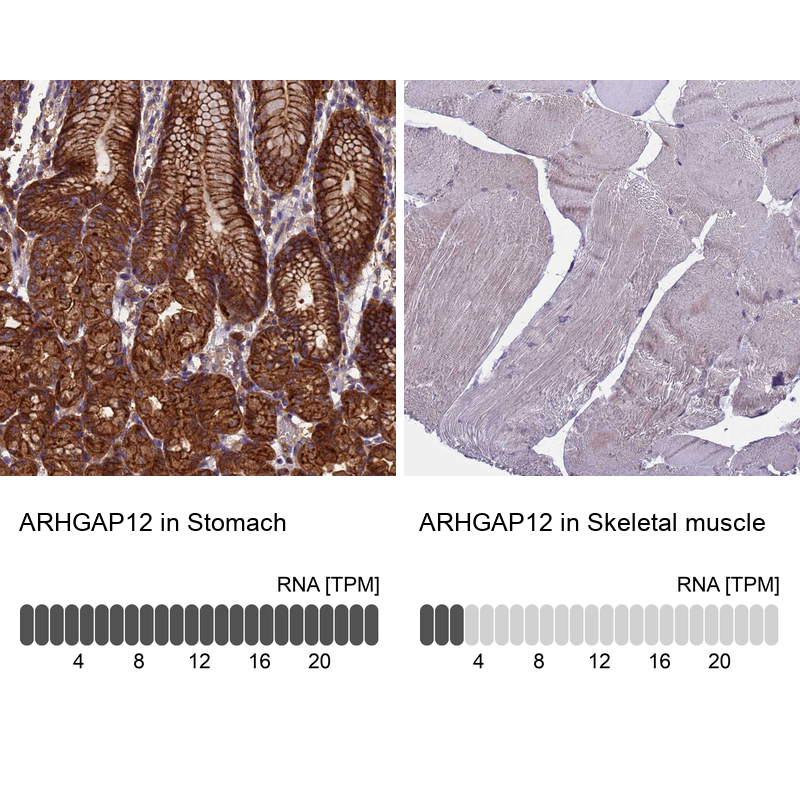 Atlas Antibodies Anti-ARHGAP12 Antibody