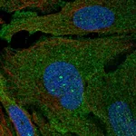 Atlas Antibodies Anti-ARHGAP19 Antibody