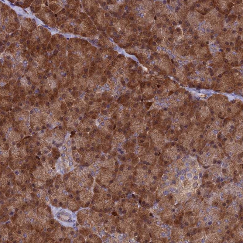 Atlas Antibodies Anti-ARHGAP18 Antibody