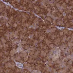 Atlas Antibodies Anti-ARHGAP18 Antibody