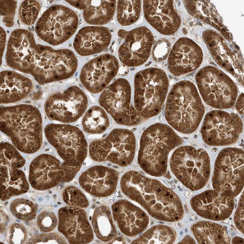 Atlas Antibodies Anti-ARHGAP15 Antibody