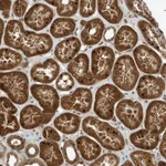 Atlas Antibodies Anti-ARHGAP15 Antibody